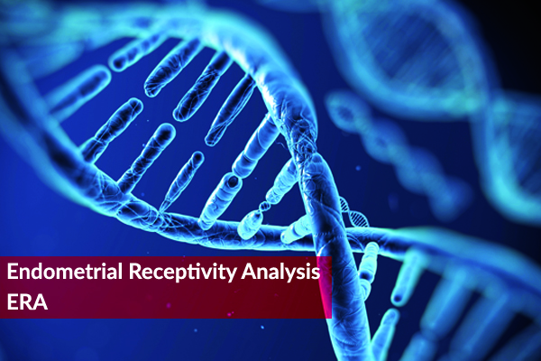 Endometrial Receptivity Analysis | Profert
